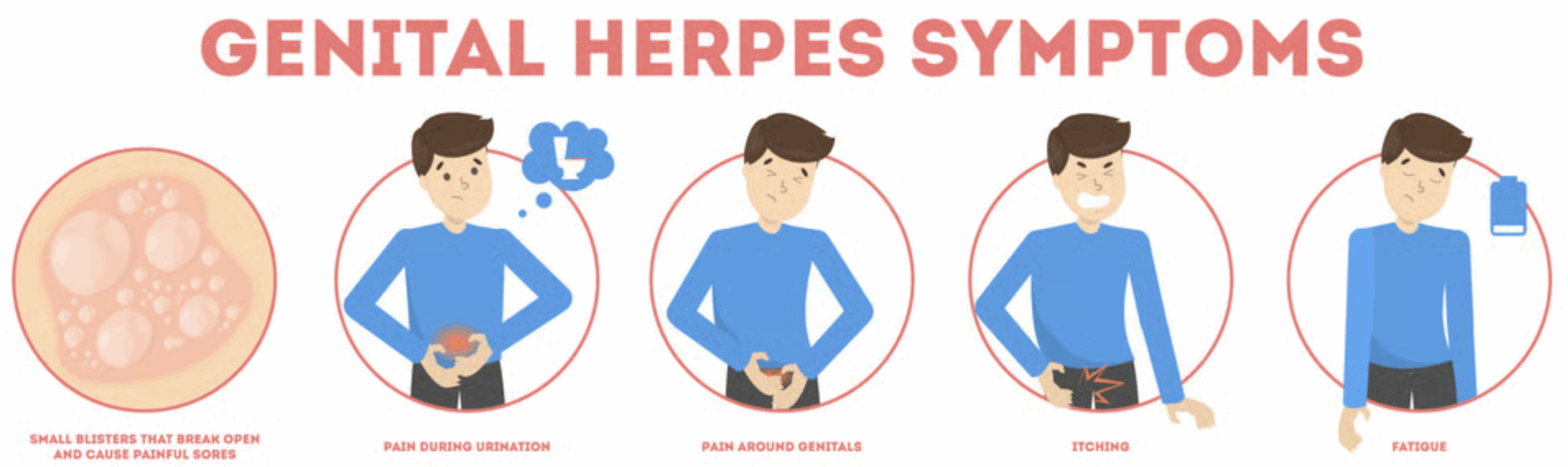 Medical guidance for Genital herpes